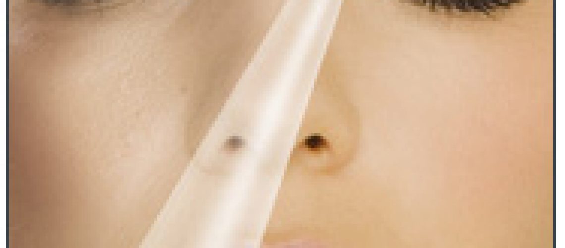 טיפול אנטי אוקסידנטים